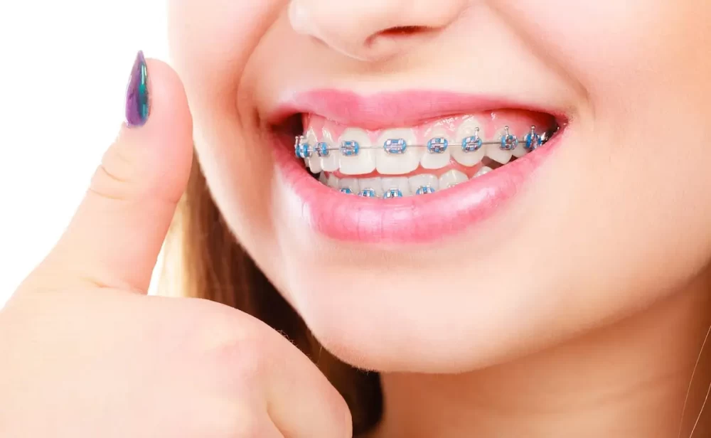 فواید ارتودنسی