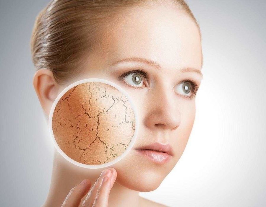 ایکتیوز یا ماهیاک چه بیماری است؟