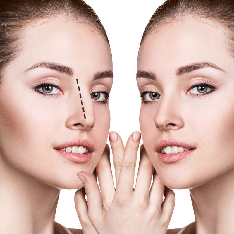 سوهان کشیدن بینی یا رسپینگ چیست؟