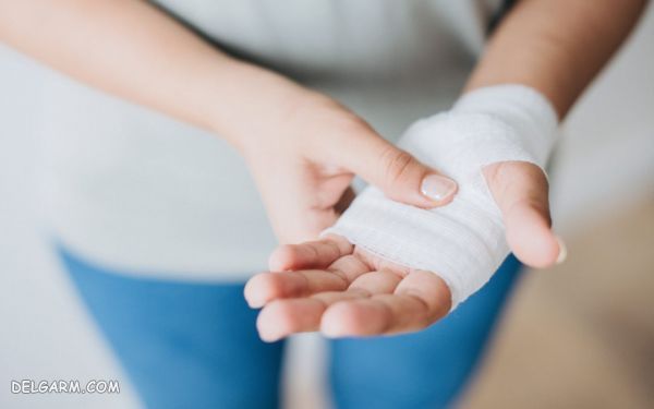 باندپیچی برای تسکین درد دست