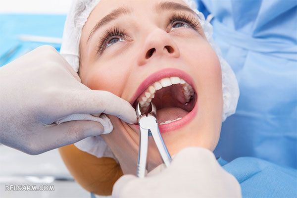 جراحی دندان عقل بدون درد