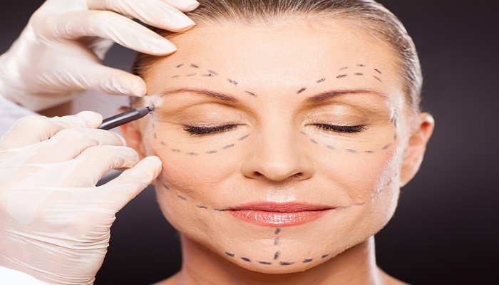 لیفت چیست؛ انواع روش های لیفت برای زیبایی