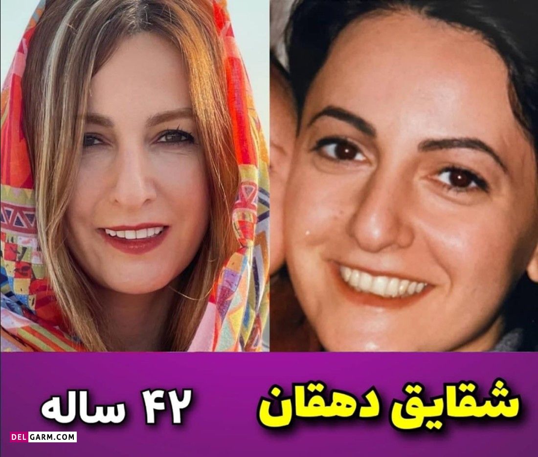 تغییر چهره بازیگران کمدی