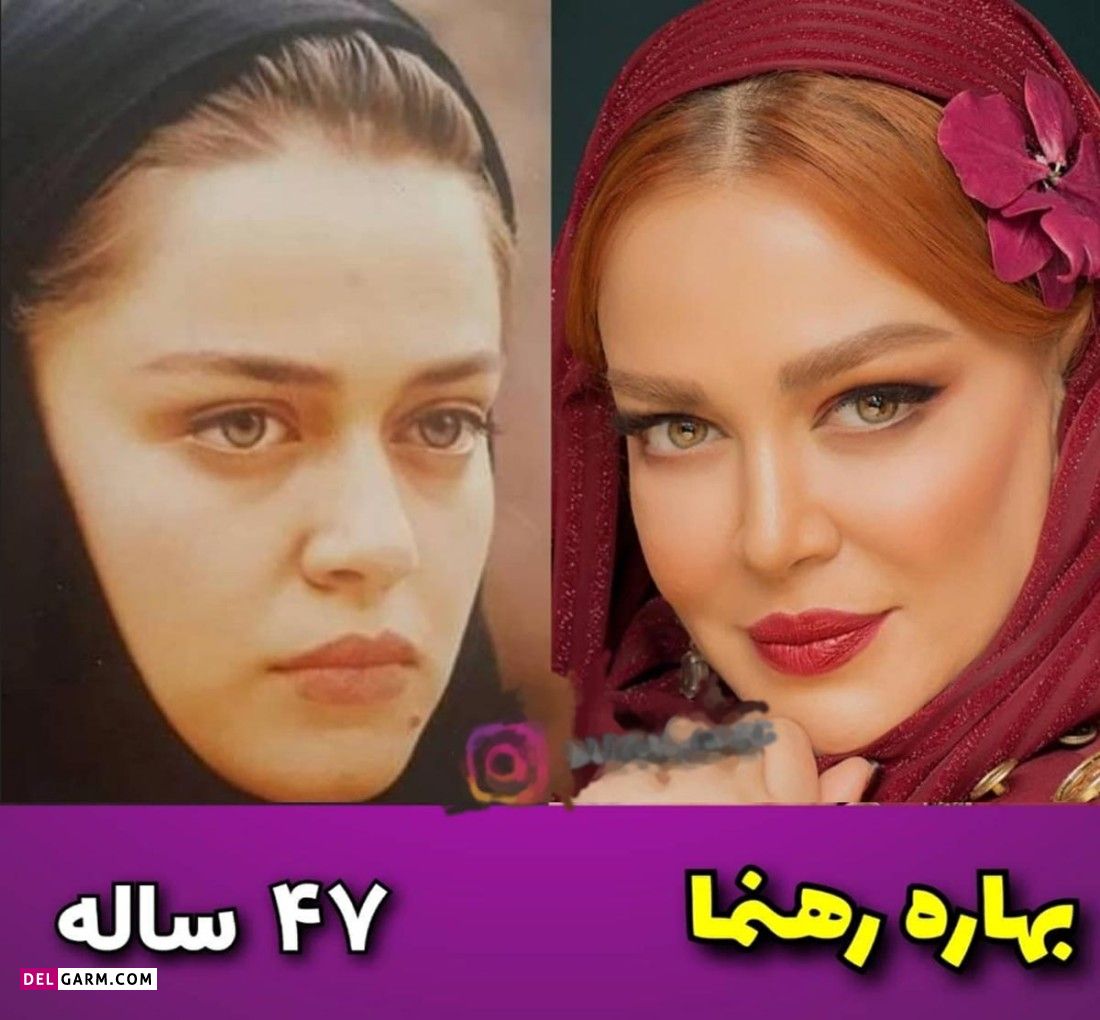 تغییر چهره بازیگران کمدی