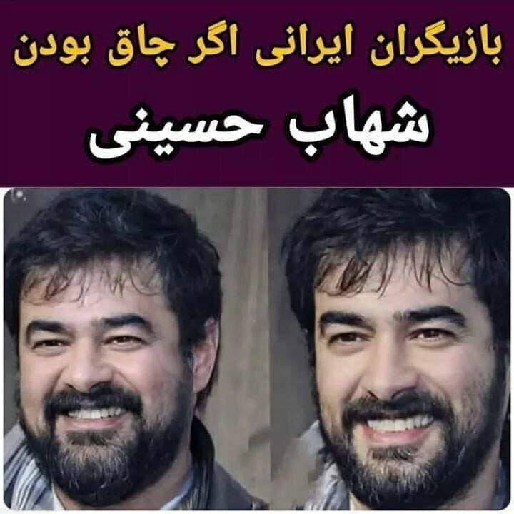چاقی بازیگران