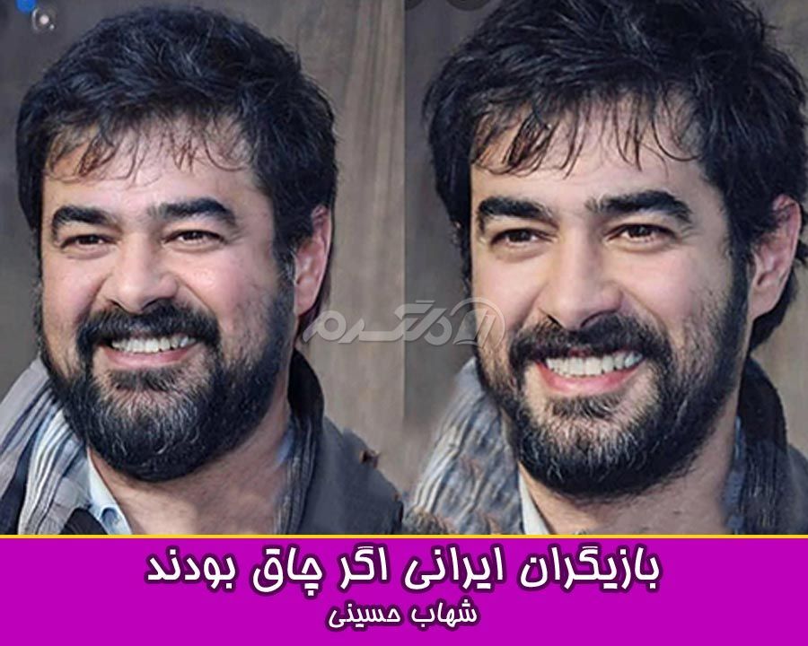 چاقی بازیگران