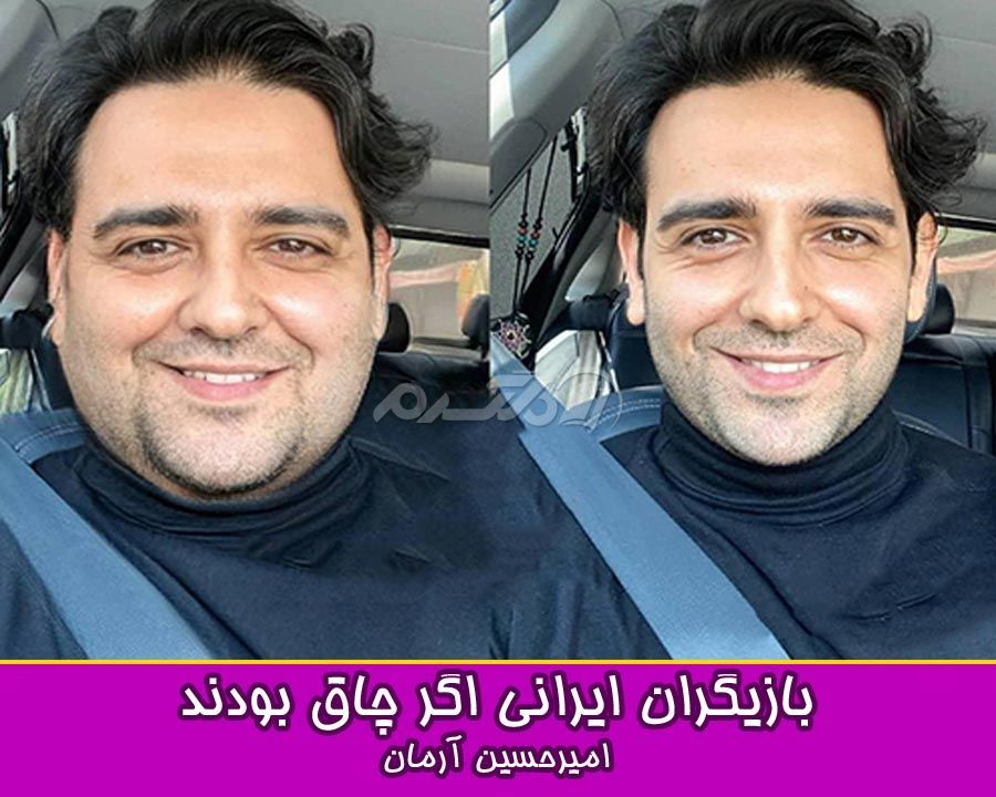 چاقی بازیگران