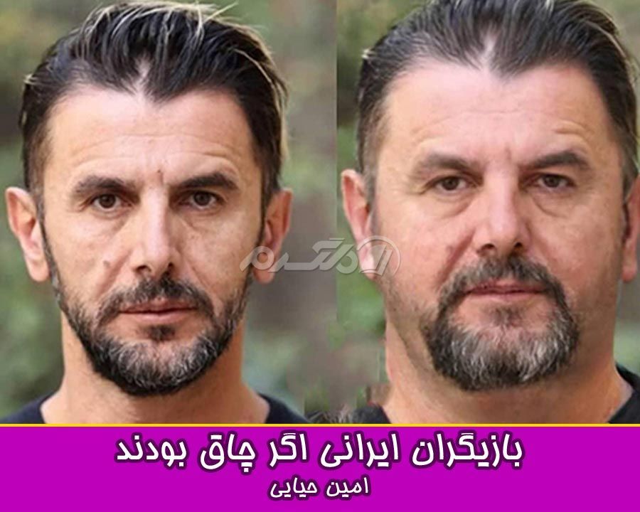 چاقی بازیگران