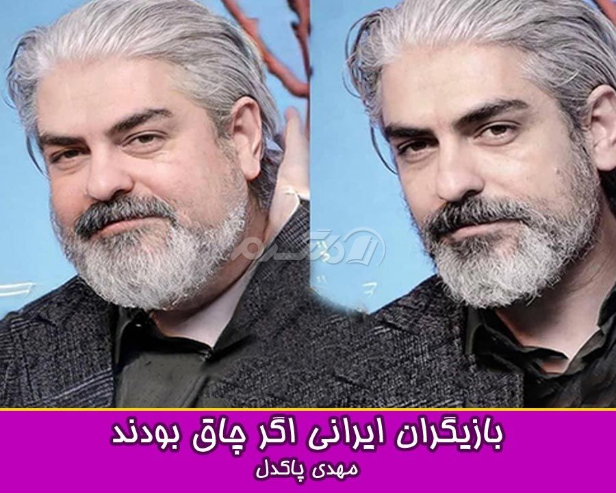 چاقی بازیگران