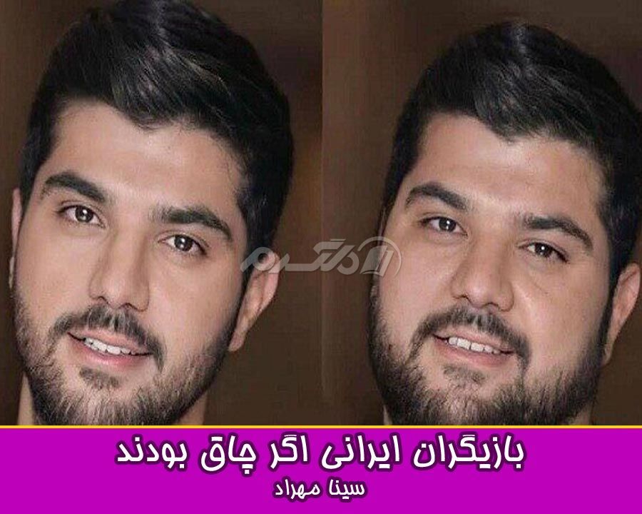 چاقی بازیگران