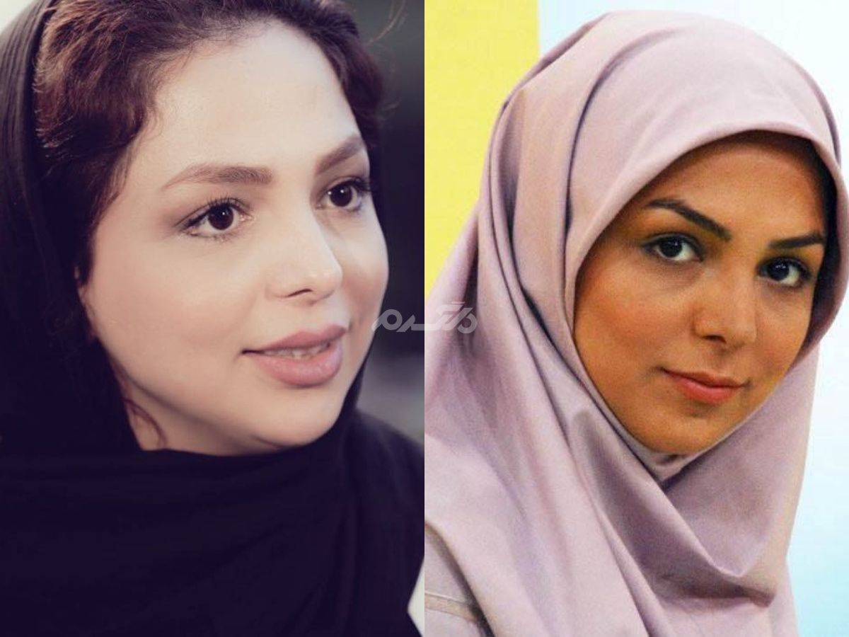 180 درجه تغییر ظاهری زهرا عاملی مجری سابق صدا و سیما بعد از جراحی های متعدد !!