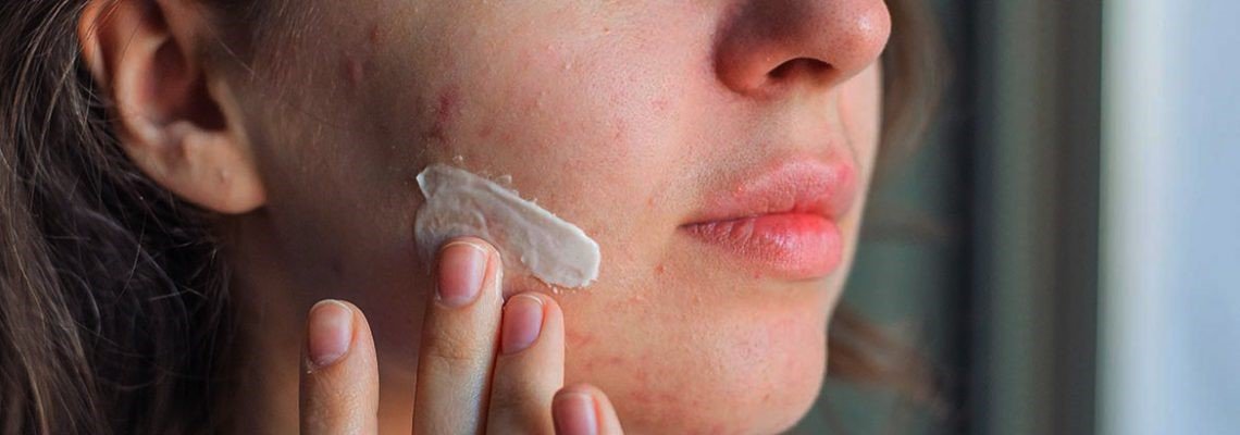 چگونه از متخصص پوست نوبت اینترنتی اخذ کنیم؟