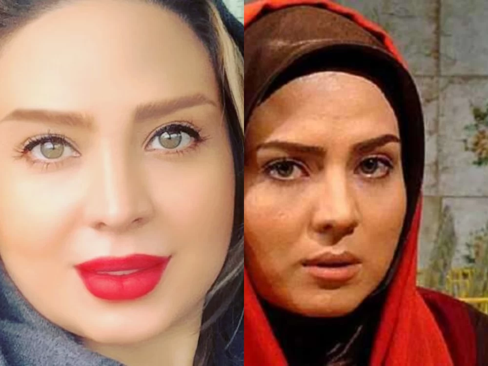 سولماز آقمقانی قبل از عمل