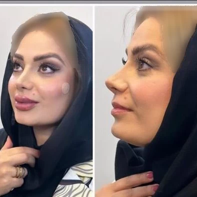 جراحی زیبایی صبا راد