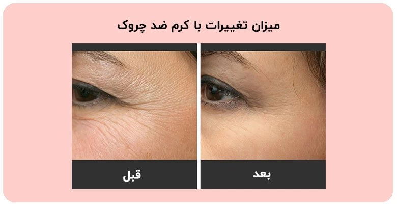 آیا کرم ضد چروک واقعا چروک ها را از بین می‌برد؟ از متخصصان بشنوید!