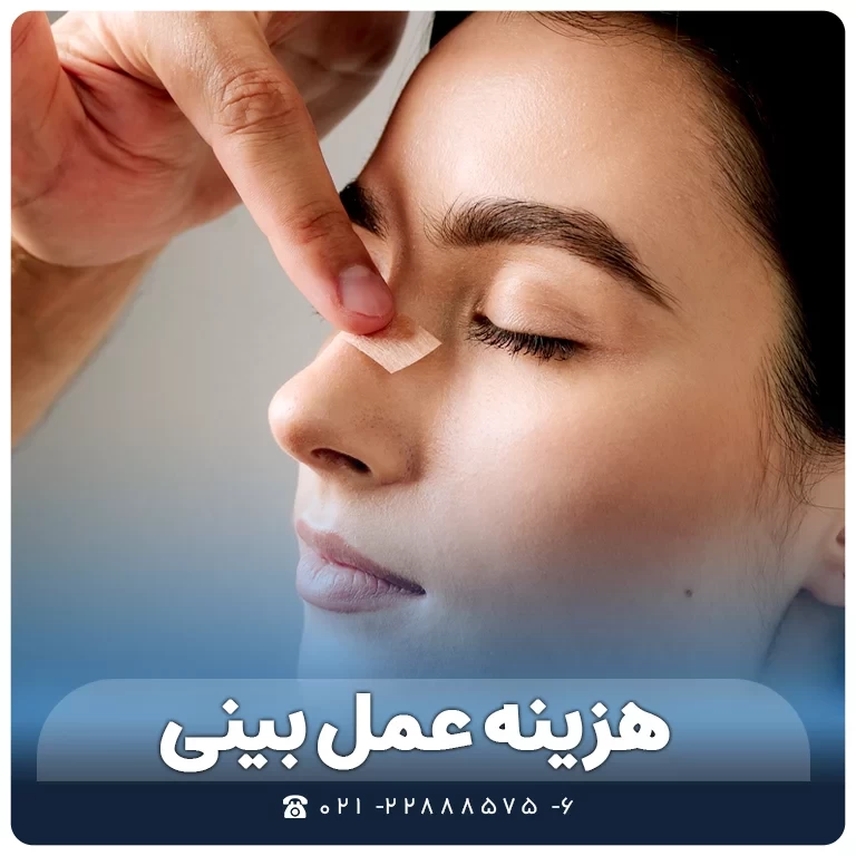 قیمت و هزینه عمل بینی