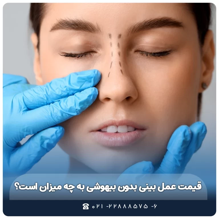 قیمت عمل بینی بدون بیهوشی به چه میزان است؟
