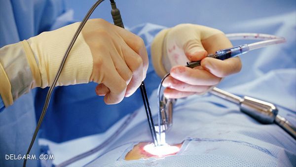 راههای تشخیص دیسک کمر