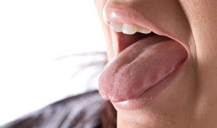 زبان دالبری یا موج دار چگونه درمان میشود ؟