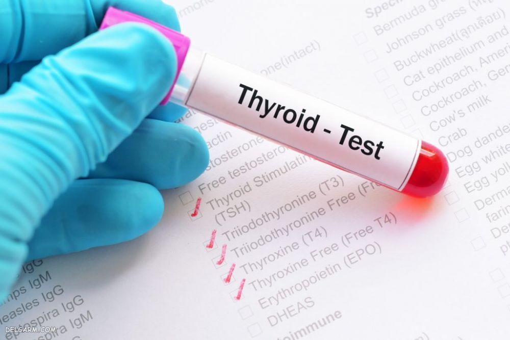 Thyroid / مهمترین علائم پرکاری تیروئید / علت پرکاری تیروئید / داروی پرکاری تیروئید / پرکاری تیروئید / درمان پرکاری تیروئید / 