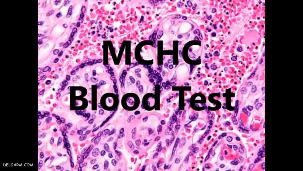  MCHC در آزمایش خون