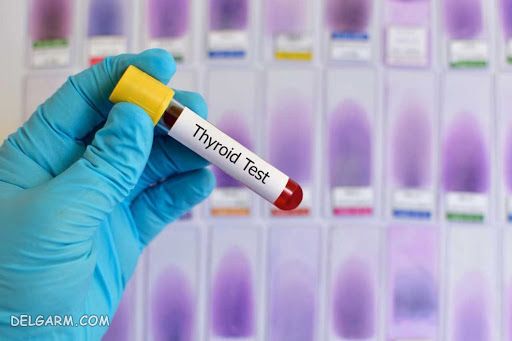 tsh نرمال چه عددی است / بالا بودن tsh / tsh نرمال / تفسیر آزمایش tsh / آزمایش tsh در بارداری / TSH در آزمایش خون