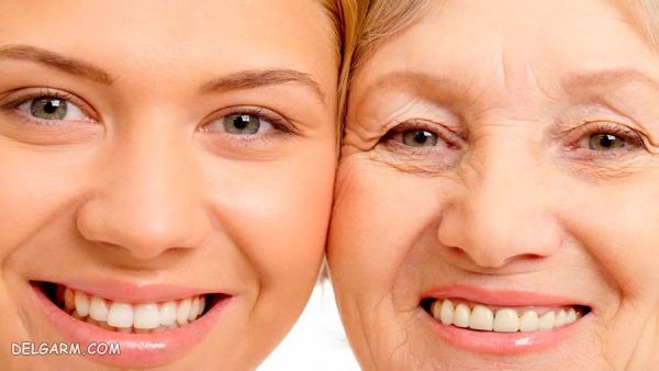 مراقبت های بعد از تزریق ژل زیر چشم