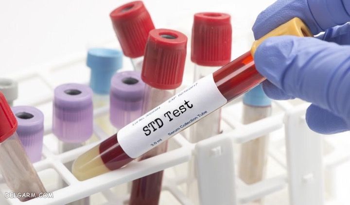 بیماری های منتقله جنسی (STDs)