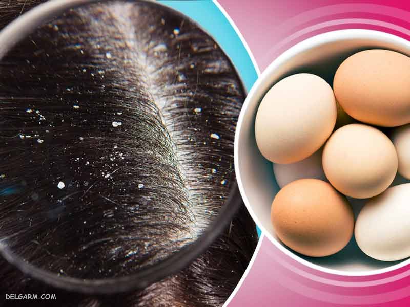 تخم مرغ برای مو