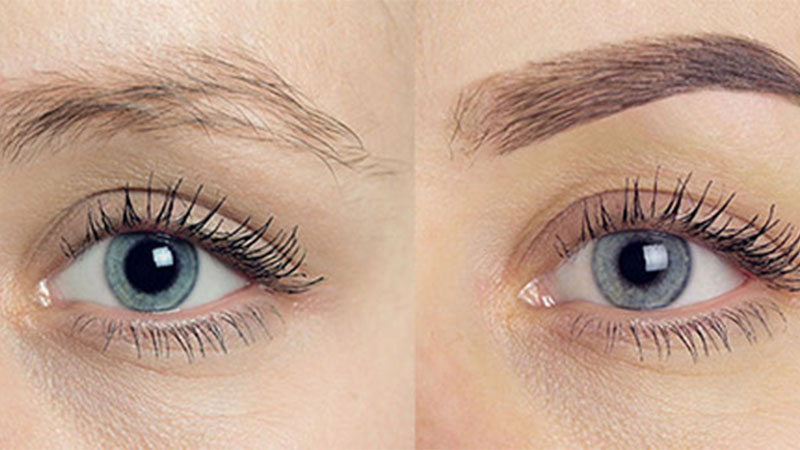 داشتن ابرویی پرپشت و طبیعی را با کاشت ابرو تجربه کنید