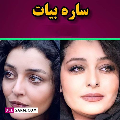 بازیگران زن ایرانی بعد از کاشت گونه