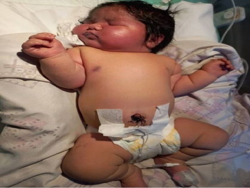 سنگین ترین نوزاد ایرانی