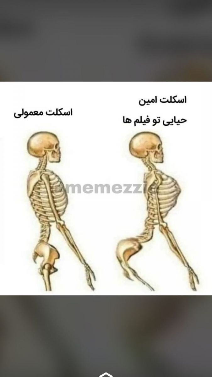 شوخی غول برره با استایل امین حیایی !