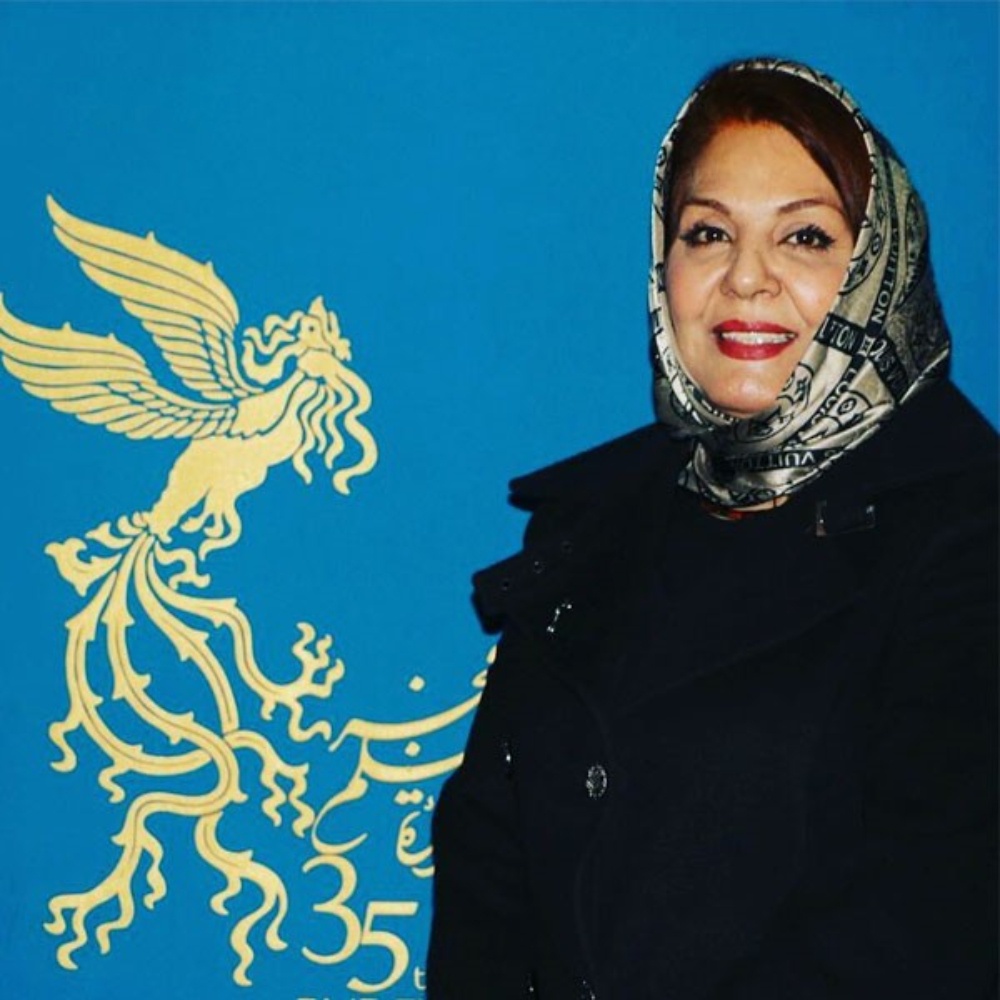 قابی از چهره ی زهره حمیدی وقتی خیلی معروف نبود
