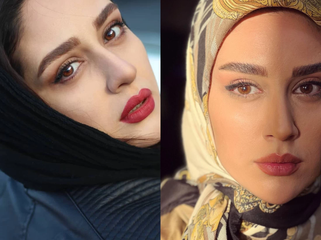 چهره ی متفاوت گلنار گیلدخت قبل از شهرت و عمل های زیبایی