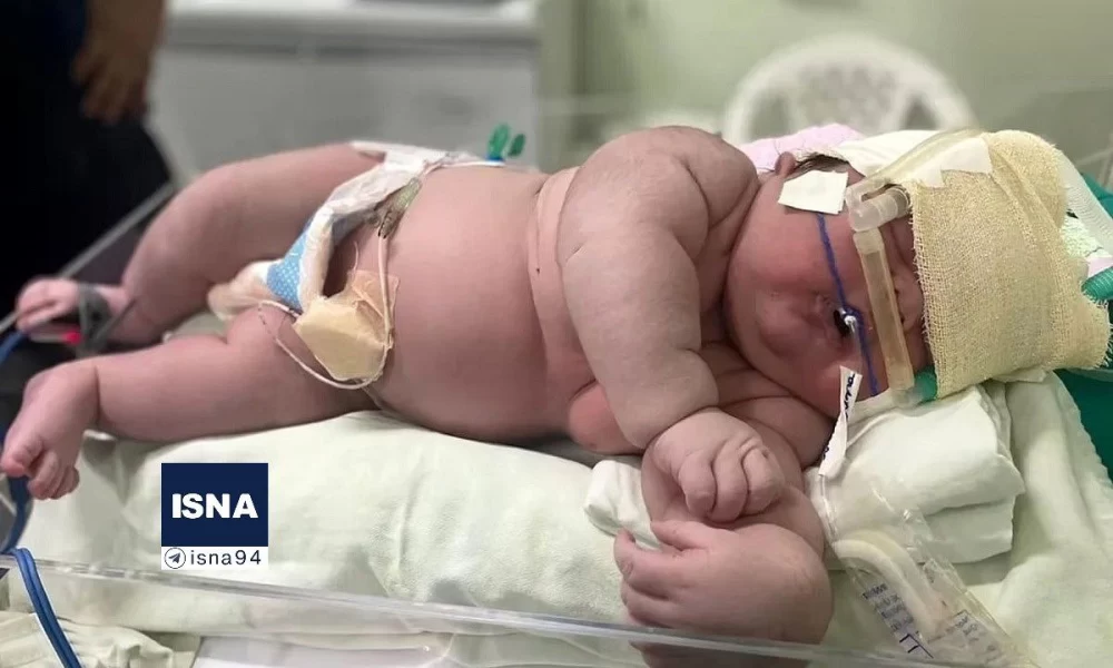 عجیب ترین نوزاد ایرانی به دنیا آمد (+عکس)