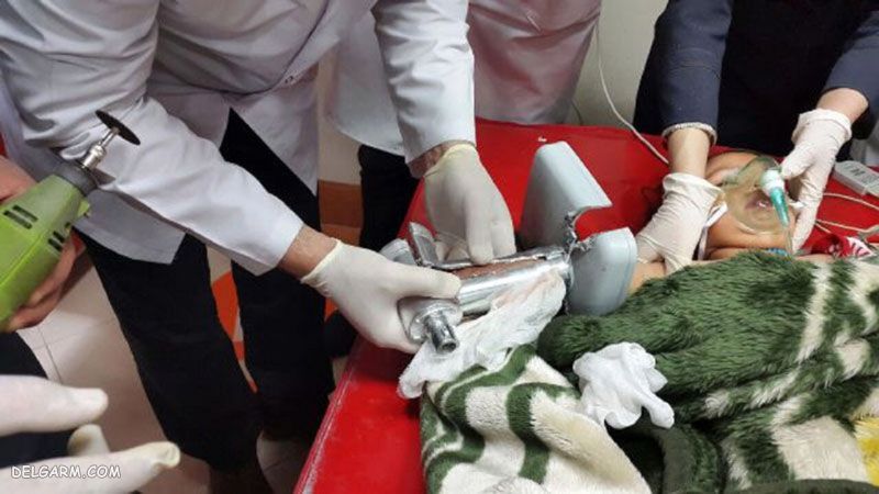 نکات ایمنی استفاده از چرخ گوشت