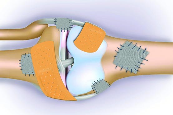 چگونه پوکی استخوان را تشخیص دهیم