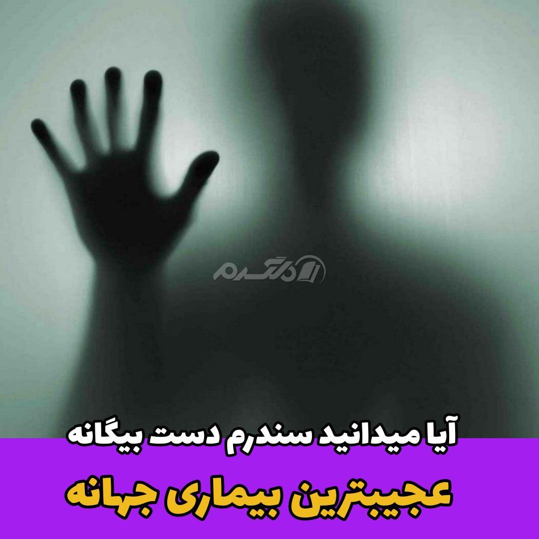 آیا میدانید / سندرم دست بیگانه