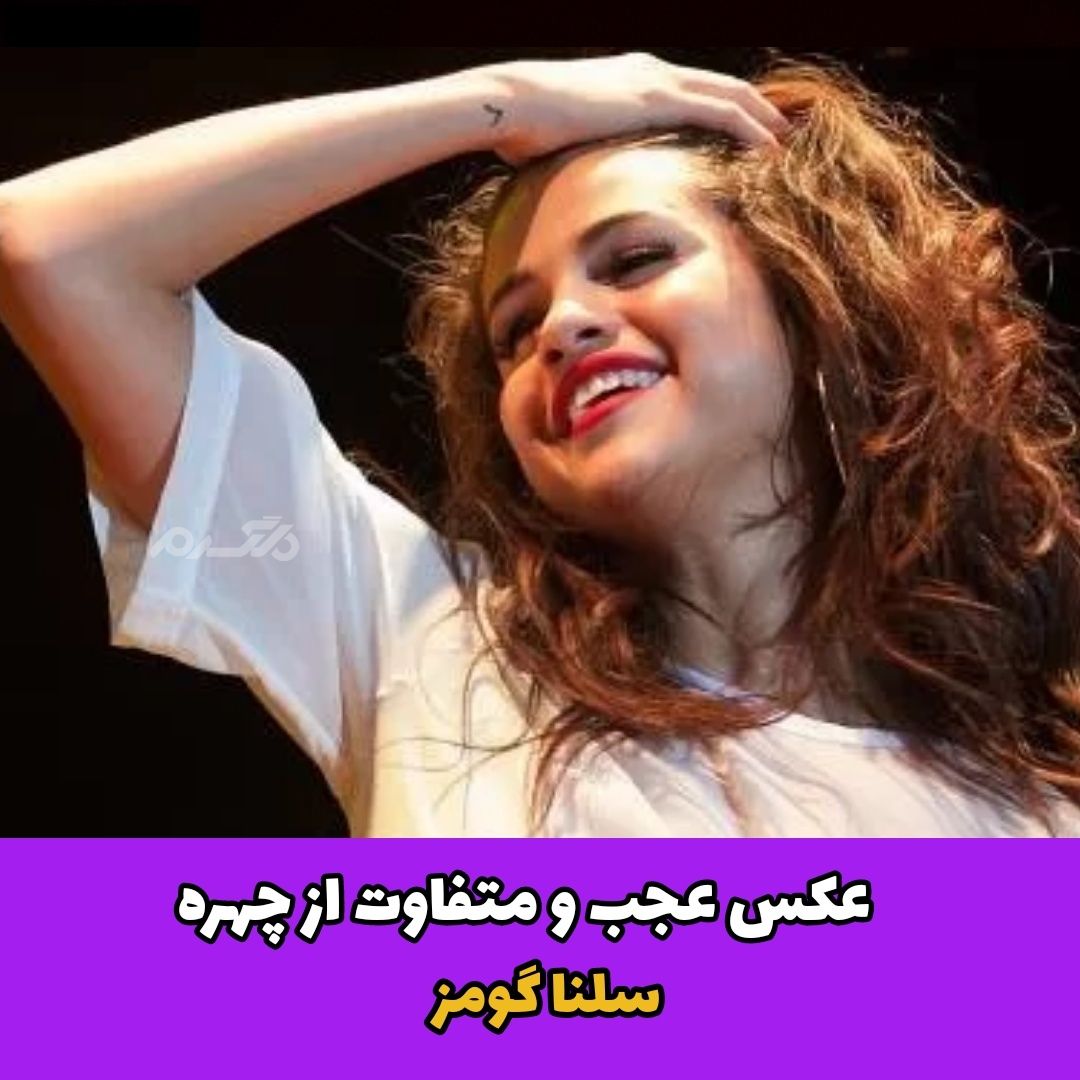عکسی عجیب و متفاوت از چهره سلنا گومز