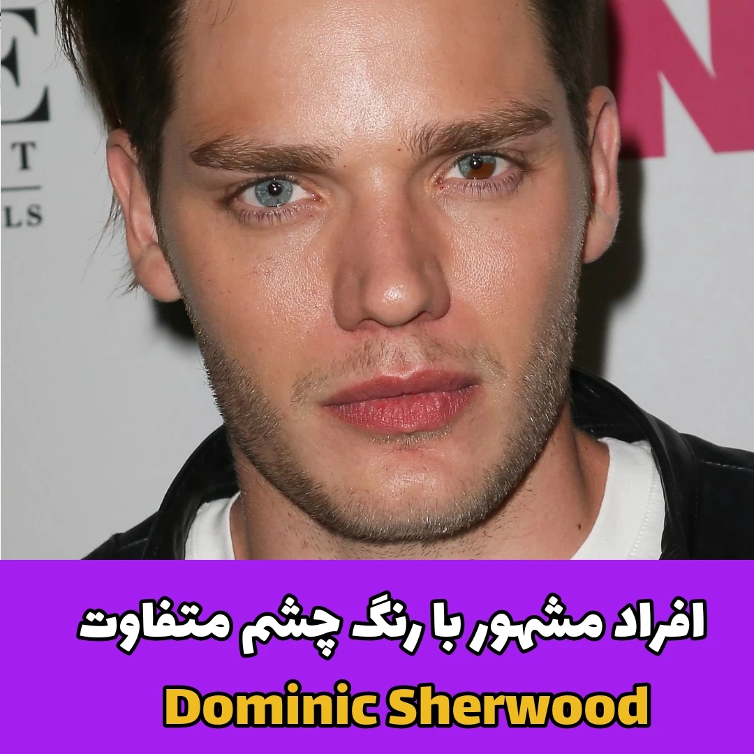 افراد مشهور با رنگ چشم متفاوت