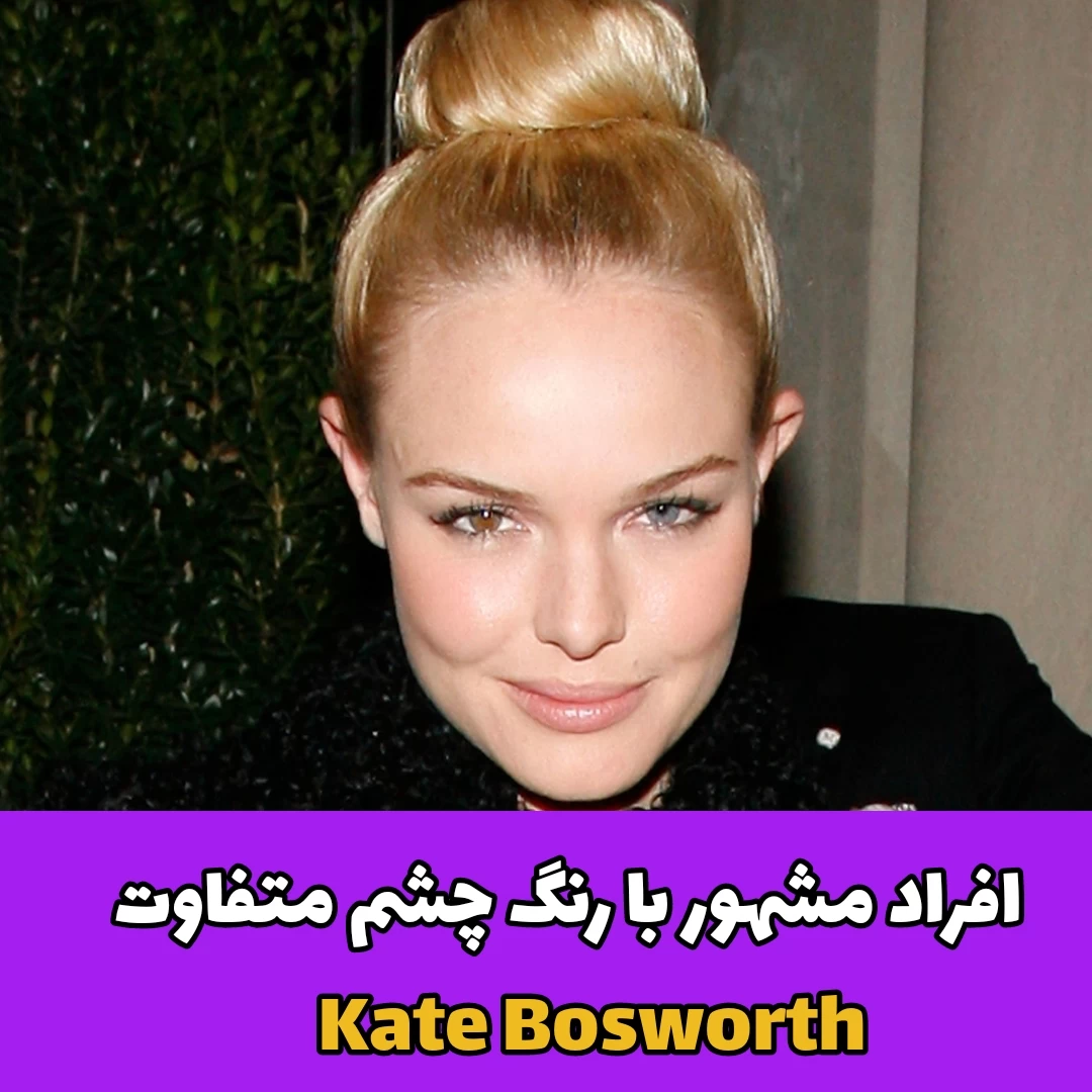 افراد مشهور با رنگ چشم متفاوت