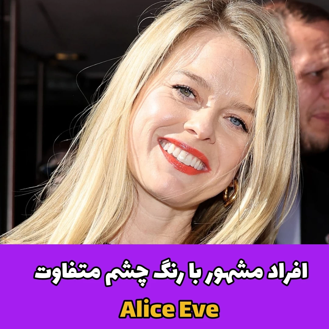 افراد مشهور با رنگ چشم متفاوت