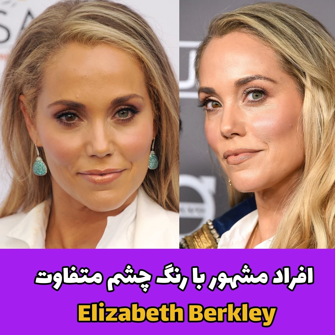 افراد مشهور با رنگ چشم متفاوت