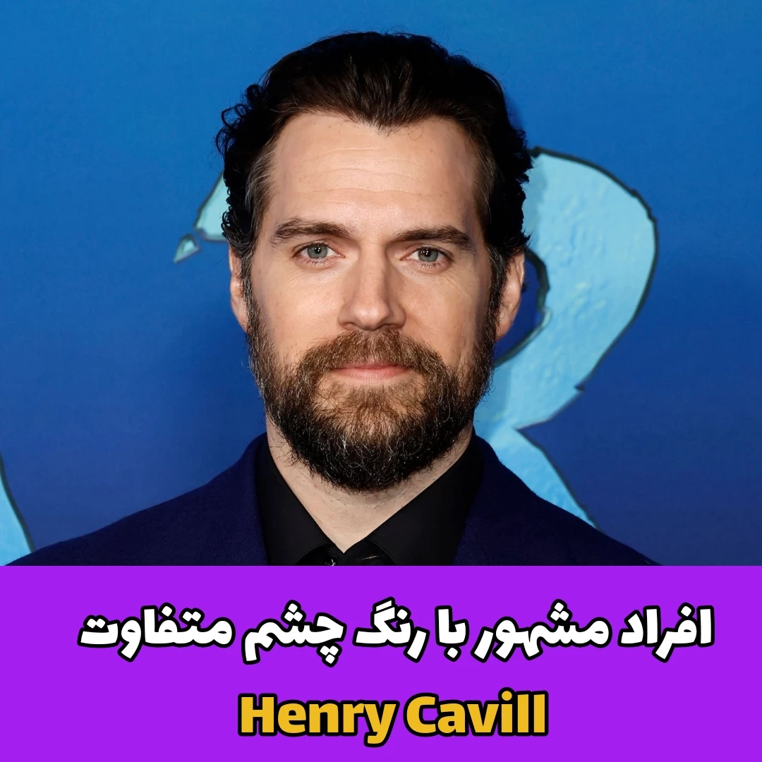 افراد مشهور با رنگ چشم متفاوت