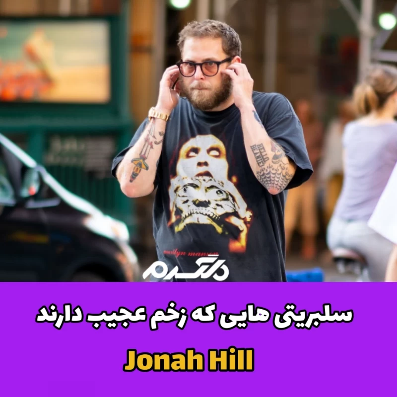 سلبریتی هایی که زخم عجیب دارند