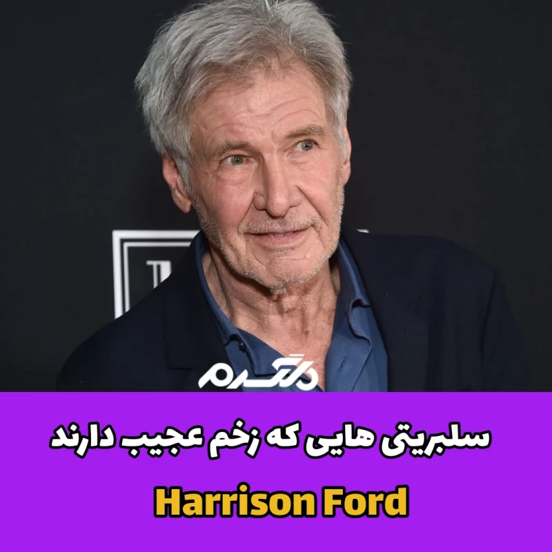 سلبریتی هایی که زخم عجیب دارند