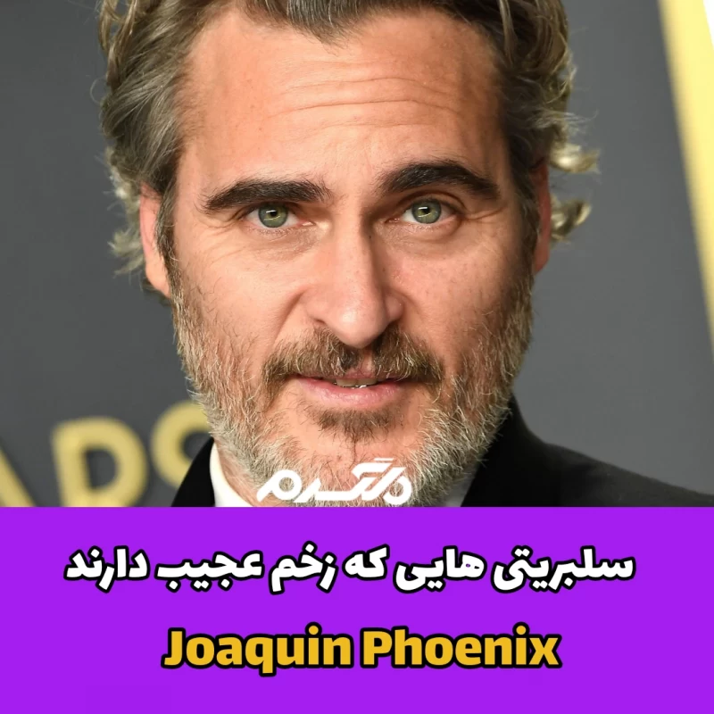 سلبریتی هایی که زخم عجیب دارند