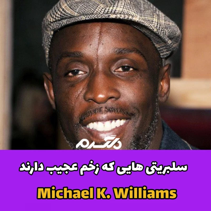 سلبریتی هایی که زخم عجیب دارند