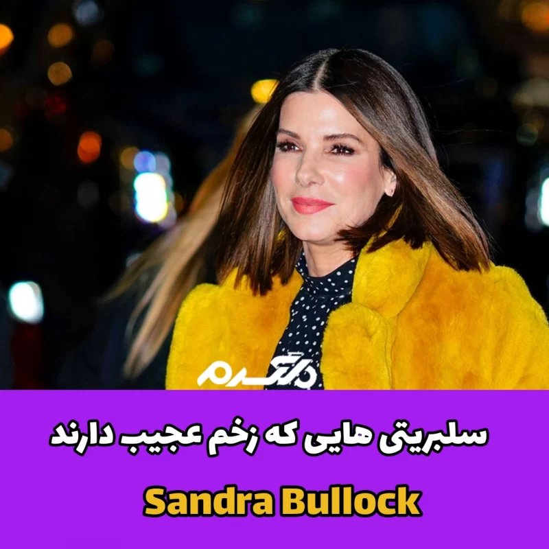 سلبریتی هایی که زخم عجیب دارند
